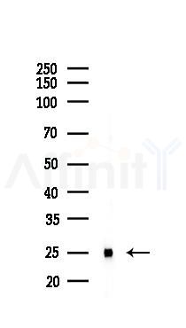 HMGB1 Recombinant Rabbit mAb - Western blot analysis of lysates from Rat lung, using HMGB1 Recombinant Rabbit mAb at 1/1000 dilution.