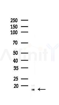Histone H2A.X Recombinant Rabbit mAb - Western blot analysis of lysates from A375 cells(heat-shock,45min treatment), using Histone H2A.