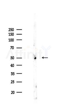 CaMKII alpha Recombinant Rabbit mAb - Western blot analysis of lysates from Mouse liver, using CaMKII Recombinant Rabbit mAb at 1/1000 dilution.