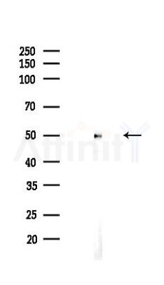 CaMKII alpha Recombinant Rabbit mAb - Western blot analysis of lysates from HepG2 cells(starvation,24h treatment), using CaMKII Recombinant Rabbit mAb at 1/1000 dilution.