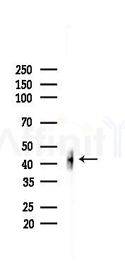 c-Fos Recombinant Rabbit mAb - Western blot analysis of lysates from A375 cells(heat-shock,45min treatment), using c-Fos Rabbit mAb at 1/1000 dilution.