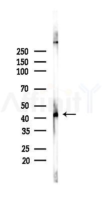 Phospho-PKA alpha/beta/gamma CAT (Thr197) Recombinant Rabbit mAb - Western blot analysis of lysates from A375 cells(heat-shock,45min treatment), using Phospho-PKA alpha/beta/gamma (catalytic subunit) (Thr197) Rabbit mAb at 1/1000 dilution.