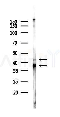 Phospho-PKA alpha/beta/gamma CAT (Thr197) Recombinant Rabbit mAb - Western blot analysis of lysates from HepG2 cells(heat-shock,45min treatment), using Phospho-PKA alpha/beta/gamma (catalytic subunit) (Thr197) Rabbit mAb at 1/1000 dilution.