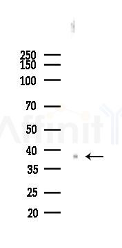 PKA alpha/beta/gamma CAT Recombinant Rabbit mAb - Western blot analysis of lysates from Rat heart, using cAMP Protein Kinase Catalytic subunit Recombinant Rabbit mAb at 1/1000 dilution.