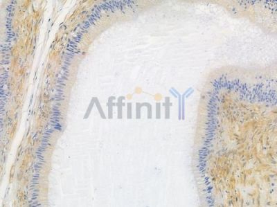 PKA alpha/beta/gamma CAT Recombinant Rabbit mAb - BF3143 at 1/100 staining human testicular cancer by IHC-P.