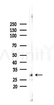 SIRT3 Recombinant Rabbit mAb - Western blot analysis of lysates from A375 cells(heat-shock,45min treatment), using SIRT3 Rabbit mAb at 1/1000 dilution.
