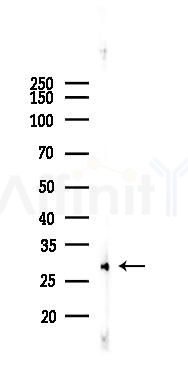 SIRT3 Recombinant Rabbit mAb - Western blot analysis of lysates from HepG2 cells(heat-shock,45min treatment), using SIRT3 Rabbit mAb at 1/1000 dilution.