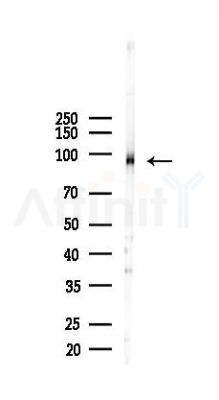 VCAM1 Recombinant Rabbit mAb - Western blot analysis of lysates from Mouse testis, using VCAM1 Recombinant Rabbit mAb at 1/1000 dilution.