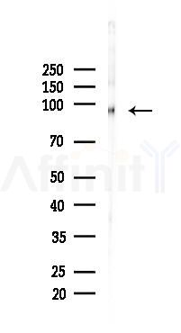 VCAM1 Recombinant Rabbit mAb - Western blot analysis of lysates from Rat brain, using VCAM1 Recombinant Rabbit mAb at 1/1000 dilution.