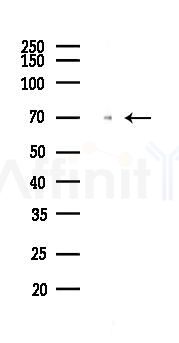 Lamin B1 Recombinant Rabbit mAb - Western blot analysis of lysates from COLO205 cells(heat-shock,45min treatment), using Lamin B1 Recombinant Rabbit mAb at 1/1000 dilution.