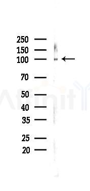 AhR Recombinant Rabbit mAb - Western blot analysis of lysates from A375 cells(heat-shock,45min treatment), using Aryl Hydrocarbon Receptor Rabbit mAb at 1/1000 dilution.