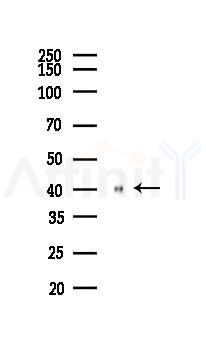Phospho-c-Jun (Ser63) Recombinant Rabbit mAb - Western blot analysis of lysates from HepG2 cells(heat-shock,45min treatment), using Phospho-c-Jun (Ser63) Rabbit mAb at 1/1000 dilution.