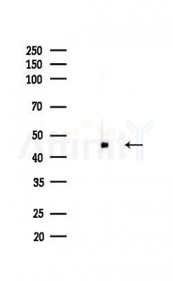 TSG101 Recombinant Rabbit mAb - Western blot analysis of lysates from HUVEC cells(LPS,4h treatment), using TSG101 Recombinant Rabbit mAb at 1/1000 dilution.