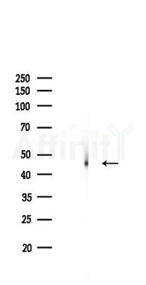 TSG101 Recombinant Rabbit mAb - Western blot analysis of lysates from Mouse liver, using TSG101 Recombinant Rabbit mAb at 1/1000 dilution.