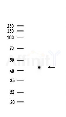 TSG101 Recombinant Rabbit mAb - Western blot analysis of lysates from HepG2 cells(starvation,24h treatment), using TSG101 Recombinant Rabbit mAb at 1/1000 dilution.