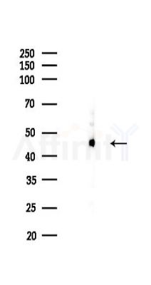 TSG101 Recombinant Rabbit mAb - Western blot analysis of lysates from Rat spleen, using TSG101 Recombinant Rabbit mAb at 1/1000 dilution.
