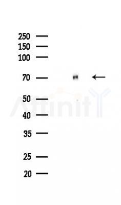HSP70 Recombinant Rabbit mAb - Western blot analysis of lysates from HUVEC cells(LPS,4h treatment), using Hsp70 Recombinant Rabbit mAb at 1/1000 dilution.