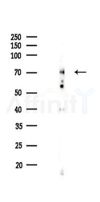 HSP70 Recombinant Rabbit mAb - Western blot analysis of lysates from Rat spleen, using Hsp70 Recombinant Rabbit mAb at 1/1000 dilution.