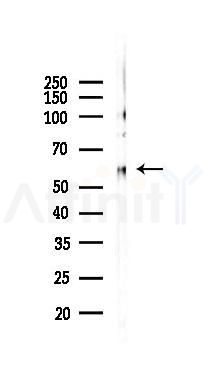 Tyrosine Hydroxylase Recombinant Rabbit mAb - Western blot analysis of lysates from Mouse brain, using Tyrosine 3-monooxygenase Recombinant Rabbit mAb at 1/1000 dilution.