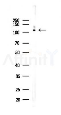 Hexokinase II Recombinant Rabbit mAb - Western blot analysis of lysates from Mouse testis, using Hexokinase II Rabbit mAb at 1/1000 dilution.