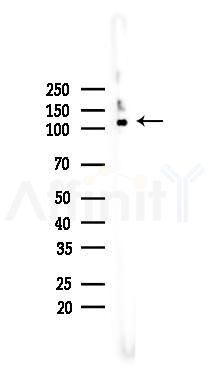 Hexokinase II Recombinant Rabbit mAb - Western blot analysis of lysates from A375 cells(heat-shock,45min treatment), using Hexokinase II Rabbit mAb at 1/1000 dilution.