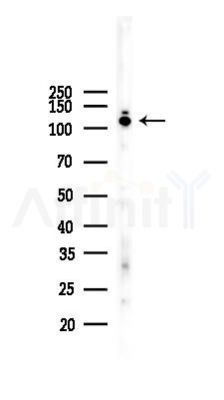 Hexokinase II Recombinant Rabbit mAb - Western blot analysis of lysates from HepG2 cells(heat-shock,45min treatment), using Hexokinase II Rabbit mAb at 1/1000 dilution.