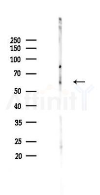 Phospho-c-Myc (Ser62) Recombinant Rabbit mAb - Western blot analysis of lysates from HepG2 cells(heat-shock,45min treatment), using Phospho-c-Myc (Ser62) Recombinant Rabbit mAb at 1/1000 dilution.
