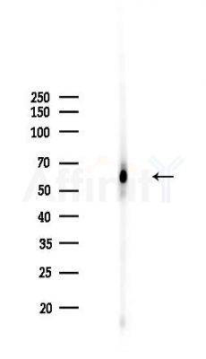 c-Myc Recombinant Rabbit mAb - Western blot analysis of lysates from COLO205 cells(LPS,4h treatment), using c-Myc Recombinant Rabbit mAb at 1/1000 dilution.