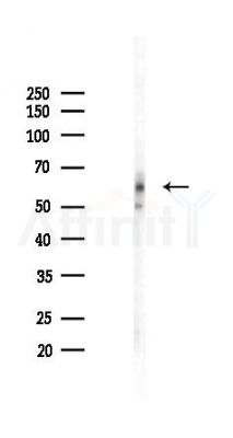 c-Myc Recombinant Rabbit mAb - Western blot analysis of lysates from HepG2 cells(heat-shock,45min treatment), using c-Myc Recombinant Rabbit mAb at 1/1000 dilution.