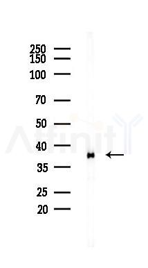 CTSK Recombinant Rabbit mAb - Western blot analysis of lysates from Rat muscle, using Cathepsin K Recombinant Rabbit mAb at 1/1000 dilution.