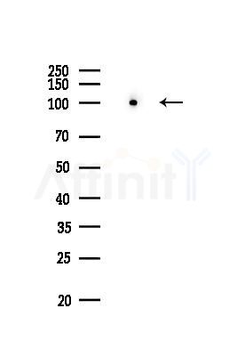 ATF6 Recombinant Rabbit mAb - Western blot analysis of lysates from EC304 cells(LPS,4h treatment), using ATF6 Rabbit mAb at 1/1000 dilution.