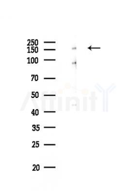 IRS1 Recombinant Rabbit mAb - Western blot analysis of lysates from EC304 cells(LPS,4h treatment), using IRS1 Rabbit mAb at 1/1000 dilution.
