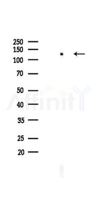 PARP Recombinant Rabbit mAb - Western blot analysis of lysates from HepG2 cells(heat-shock,45min treatment), using PARP1 Recombinant Rabbit mAb at 1/1000 dilution.