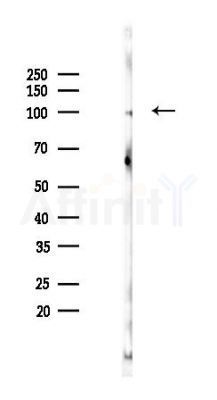 PARP Recombinant Rabbit mAb - Western blot analysis of lysates from Rat lung, using PARP1 Recombinant Rabbit mAb at 1/1000 dilution.