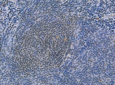 PARP Recombinant Rabbit mAb - BF3170 at 1/100 staining human normal tonsil tissue by IHC-P.