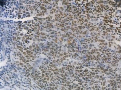 PARP Recombinant Rabbit mAb - BF3170 at 1/100 staining human normal tonsil tissue by IHC-P.