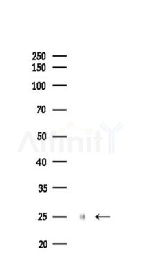 Cleaved PARP Recombinant Rabbit mAb - Western blot analysis of lysates from Hela cells(LPS,4h treatment), using Cleaved PARP1 Recombinant Rabbit mAb at 1/1000 dilution.