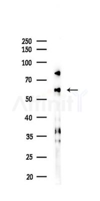 TRAF6 Recombinant Rabbit mAb - Western blot analysis of lysates from Hela cells(LPS,4h treatment), using TRAF6 Recombinant Rabbit mAb at 1/1000 dilution.