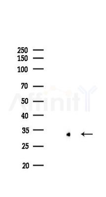 CHOP Recombinant Rabbit mAb - Western blot analysis of lysates from COLO205 cells(LPS,4h treatment), using DDIT3 Recombinant Rabbit mAb at 1/1000 dilution.