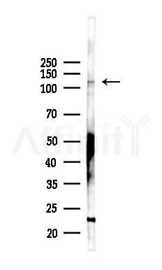 ITGAM Recombinant Rabbit mAb - Western blot analysis of lysates from B16F10-LUC cells(LPS 4h treatment), using CD11b Recombinant Rabbit mAb at 1/1000 dilution.