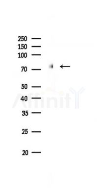 FOXO1A Recombinant Rabbit mAb - Western blot analysis of lysates from PC12 cells(LPS,4h treatment), using FOXO1A Recombinant Rabbit mAb at 1/1000 dilution.