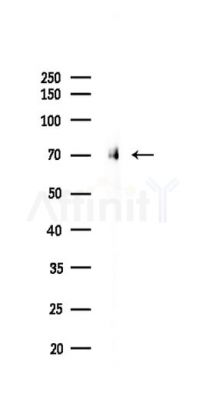 FOXO1A Recombinant Rabbit mAb - Western blot analysis of lysates from Hela cells(LPS,4h treatment), using FOXO1A Recombinant Rabbit mAb at 1/1000 dilution.