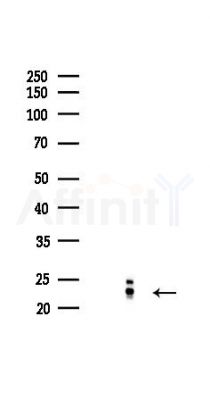 FGF2 Recombinant Rabbit mAb - Western blot analysis of lysates from HepG2 cells(heat-shock,45min treatment), using FGF2 Recombinant Rabbit mAb at 1/1000 dilution.