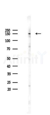 Phospho-ULK1 (Ser556) Recombinant Rabbit mAb - Western blot analysis of lysates from Hela cells(heat-shock 45min treatment), using Phospho-ULK1 (Ser556) Recombinant Rabbit mAb at 1/1000 dilution.