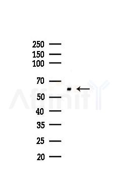 Src Recombinant Rabbit mAb - Western blot analysis of lysates from HUVEC cells(LPS,4h treatment), using Src Recombinant Rabbit mAb at 1/1000 dilution.