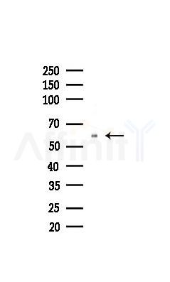 Src Recombinant Rabbit mAb - Western blot analysis of lysates from COLO205 cells(heat-shock,45min treatment), using Src Recombinant Rabbit mAb at 1/1000 dilution.
