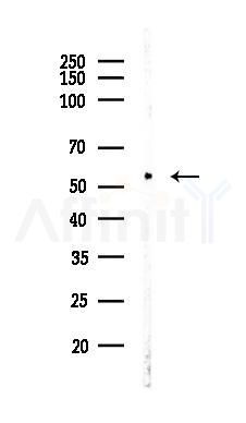 Smad2/3 Recombinant Rabbit mAb - Western blot analysis of lysates from A375 cells(heat-shock,45min treatment), using Smad2/3 Recombinant Rabbit mAb at 1/1000 dilution.