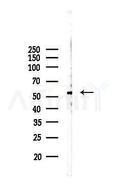 Smad2/3 Recombinant Rabbit mAb - Western blot analysis of lysates from COLO205 cells(LPS, 4h treatment), using Smad2/3 Recombinant Rabbit mAb at 1/1000 dilution.