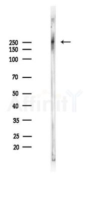 PDGF Receptor alpha Recombinant Rabbit mAb - Western blot analysis of lysates from Rat brain, using PDGF Receptor alpha Recombinant Rabbit mAb at 1/1000 dilution.