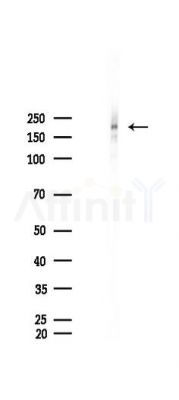 PDGF Receptor alpha Recombinant Rabbit mAb - Western blot analysis of lysates from Mouse lung, using PDGF Receptor alpha Recombinant Rabbit mAb at 1/1000 dilution.